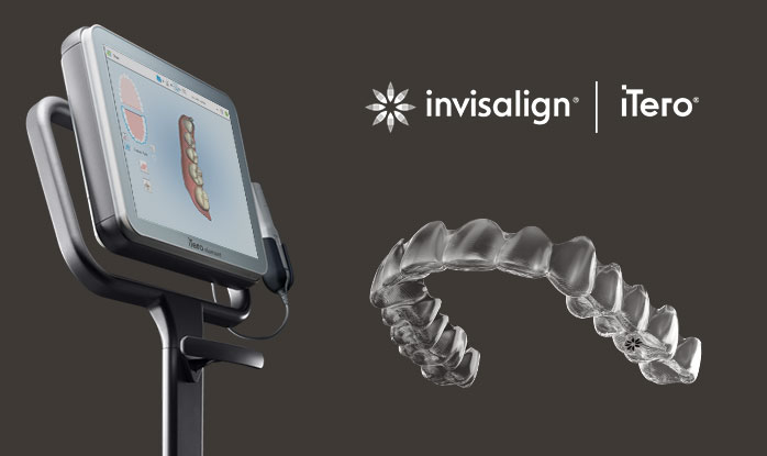 Invisalign system