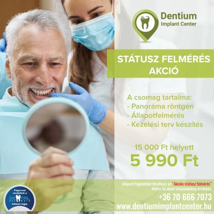 Státusz Felmérés AKCIÓ Státusz Felmérés AKCIÓ