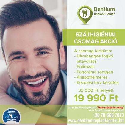 Szájhigiéniai Csomag AKCIÓ Szájhigiéniai Csomag AKCIÓ
